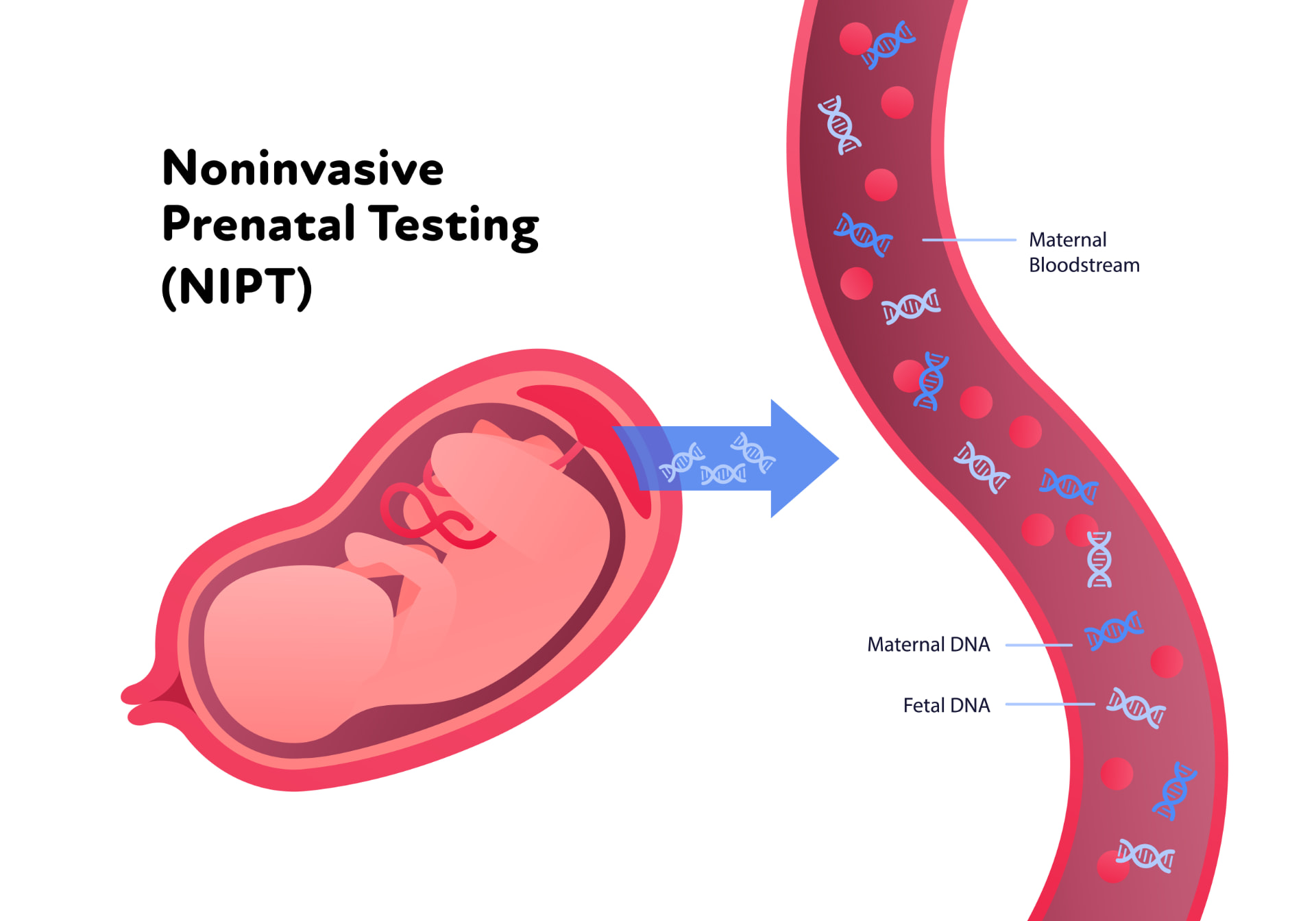 Noninvasive prenatal testing diagram showing maternal and fetal DNA circulating together in the maternal bloodstream