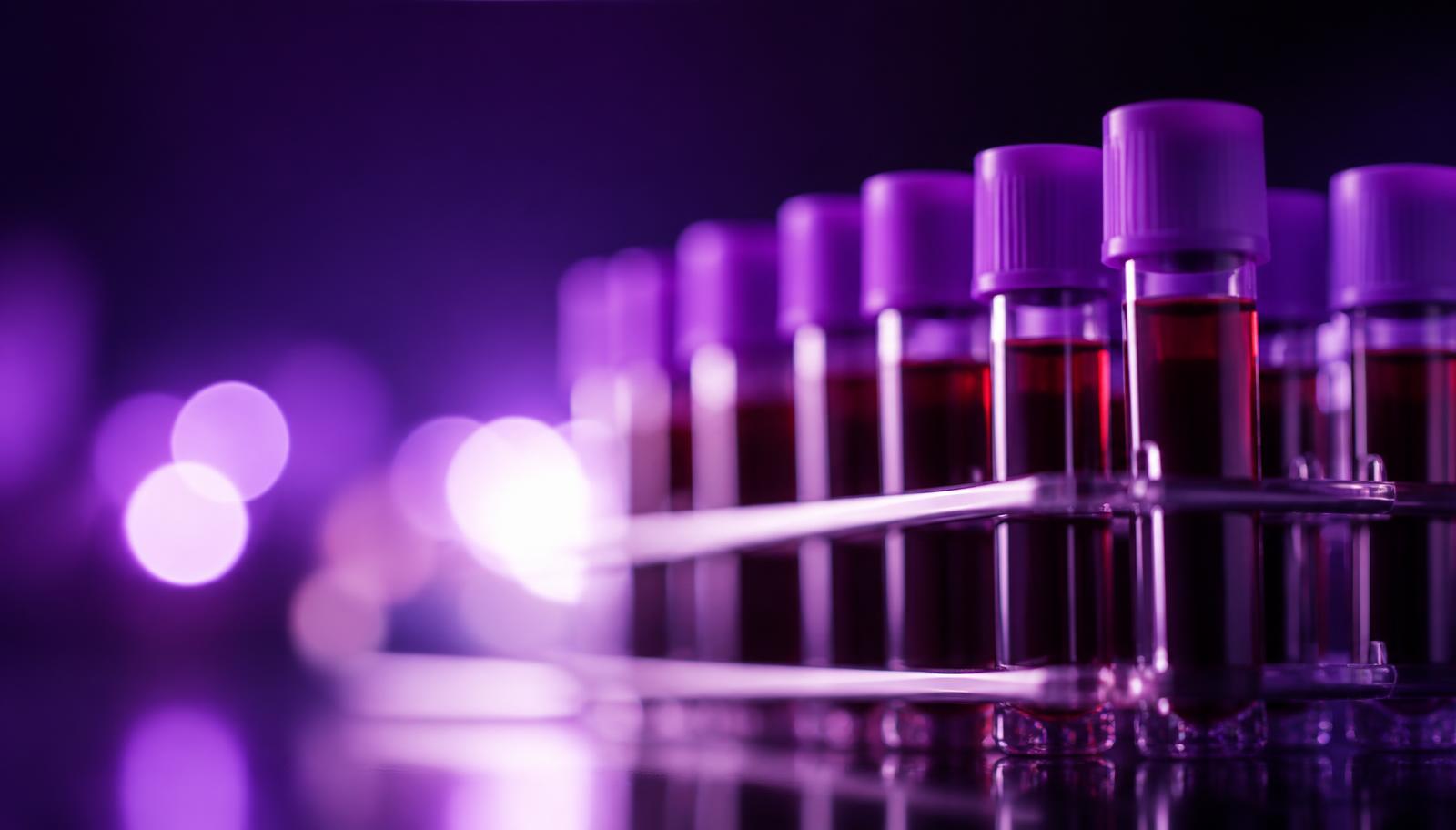 Blood sample tubes in a rack ready for analysis at an accredited pathology laboratory